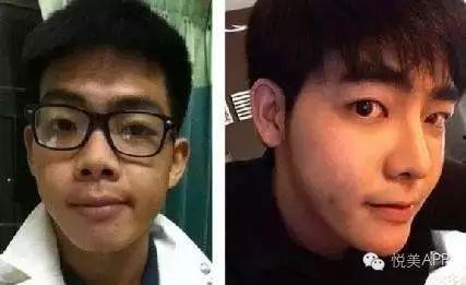 男网红整容脸吃瓜视频,吃瓜群众热议的整形真相